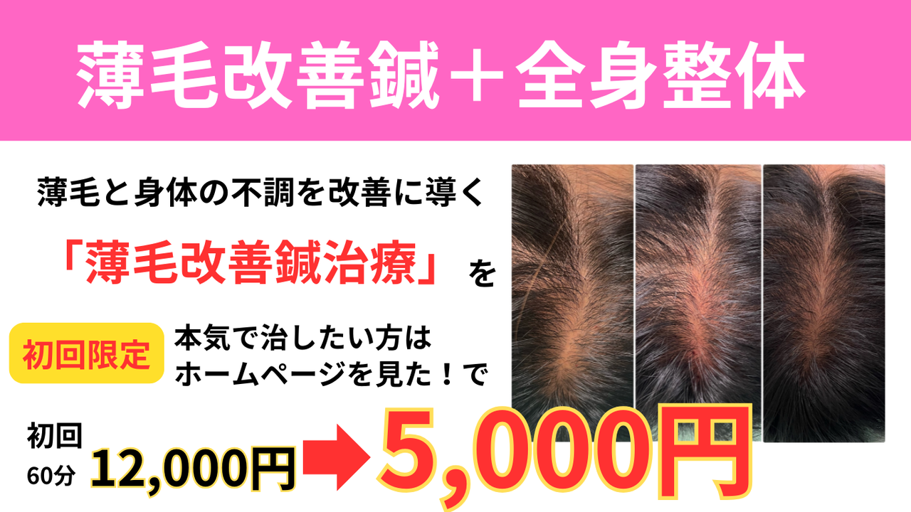 姫路で薄毛・育毛にお悩みならオオヤ鍼灸整骨院 姫路駅前店の育毛鍼＋全身整体が初回限定5,000円で受けられる割引キャンペーンをご活用ください。