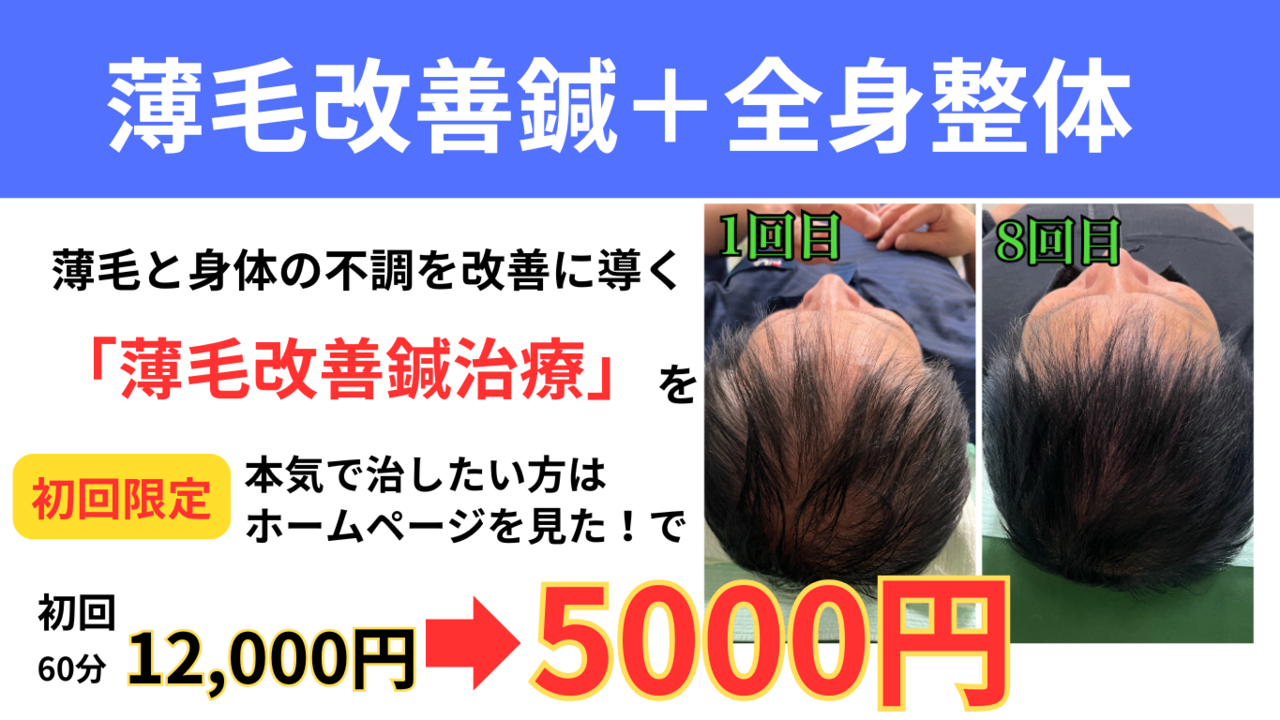 オオヤ鍼灸整骨院　姫路駅前店の薄毛鍼　初回割引