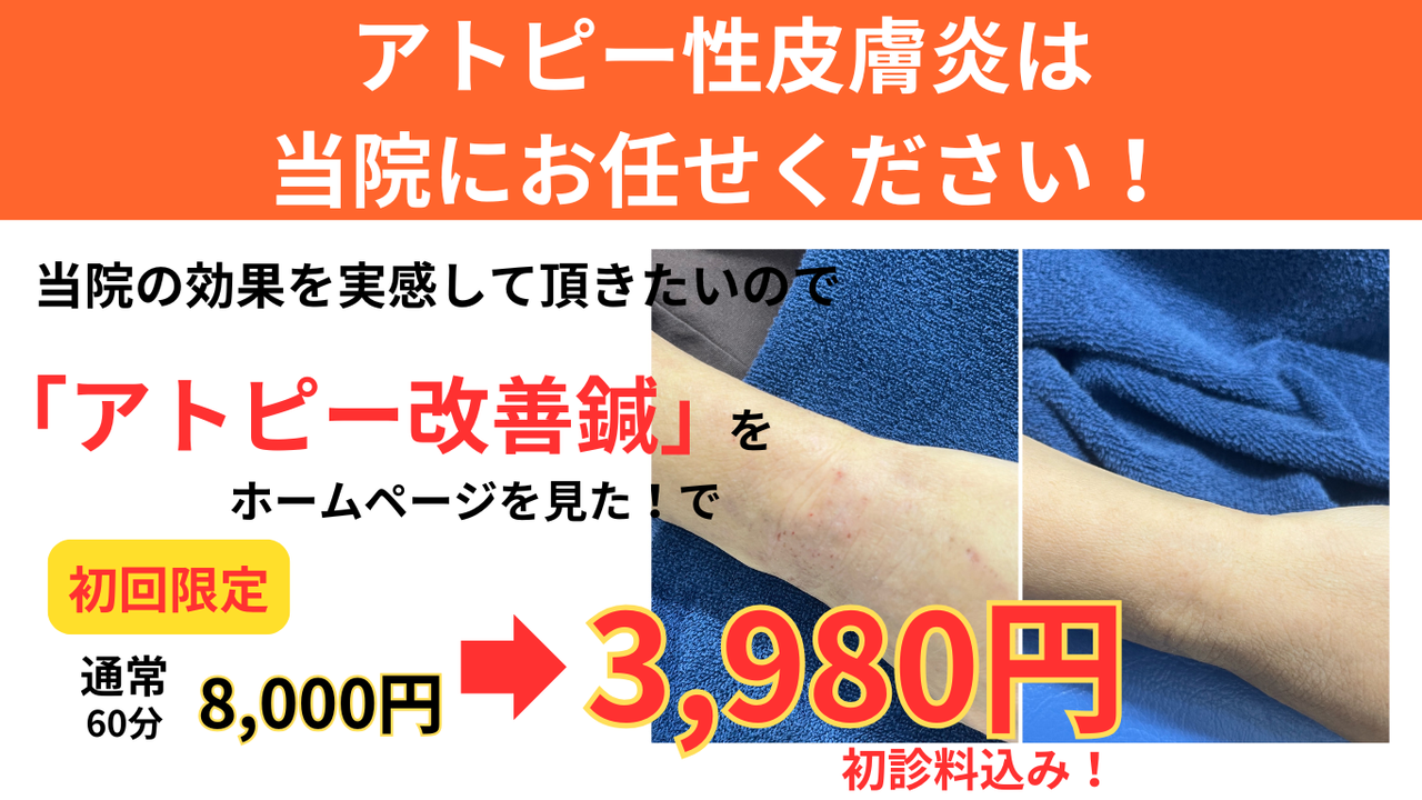 オオヤ鍼灸整骨院　姫路駅前店のアトピー性皮膚炎改善鍼　初回割引
