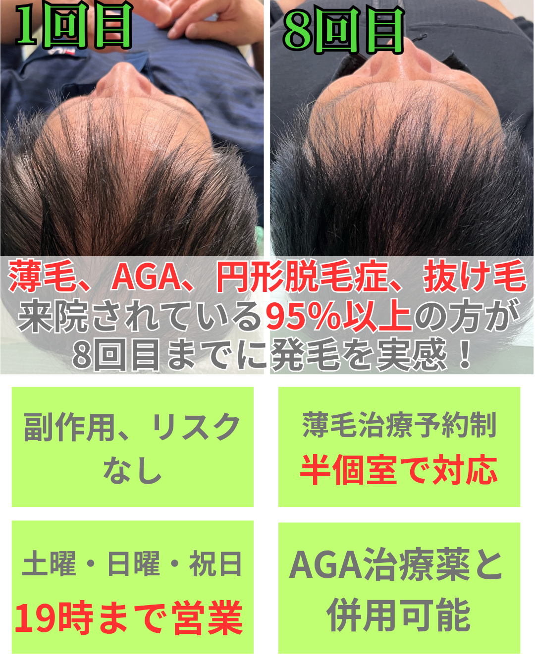 薄毛治療にお悩みの方へ