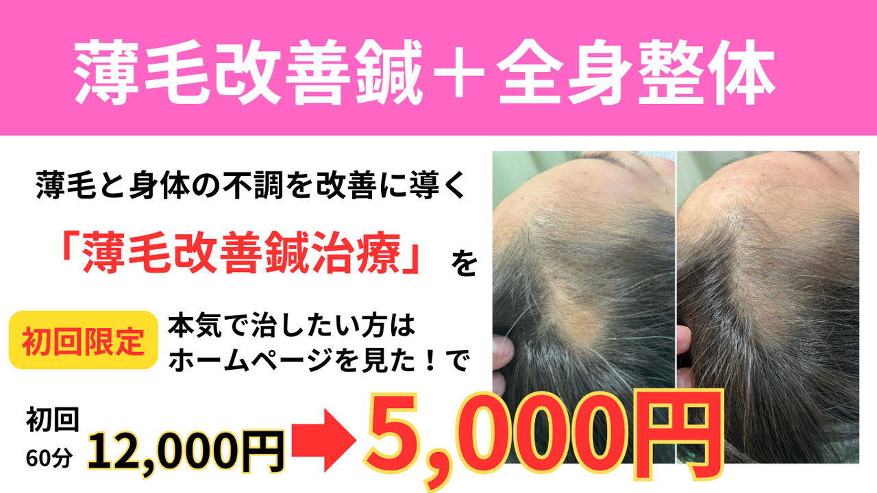 姫路で女性の薄毛、円形脱毛症、産後脱毛にお悩みならオオヤ鍼灸整骨院 姫路駅前店の薄毛改善鍼＋全身整体が初回限定5,000円で受けられる割引キャンペーンをご活用ください。