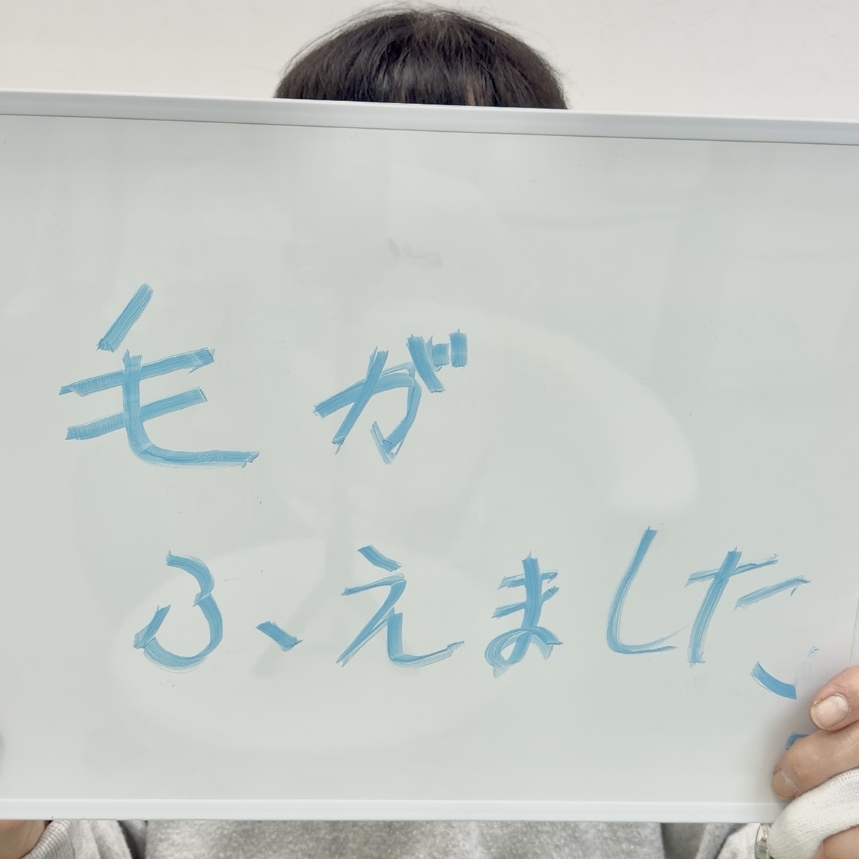 薄毛改善鍼を受けられた患者様の声「毛が増えました」