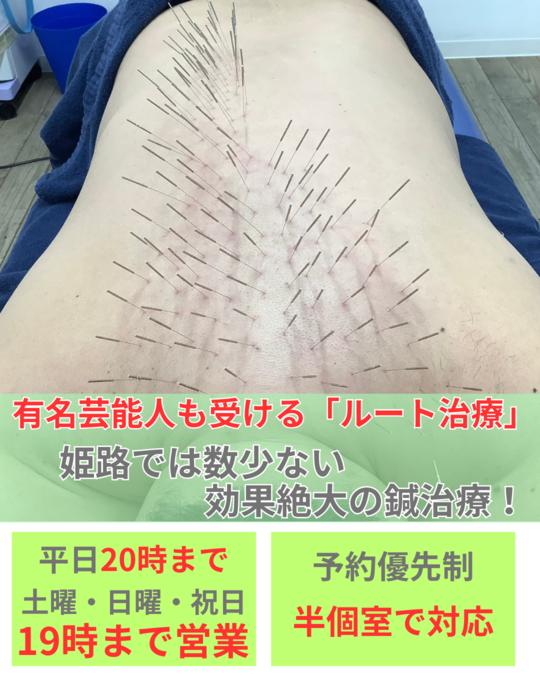 オオヤ鍼灸整骨院　姫路駅前店の有名芸能人も受ける「ルート治療」