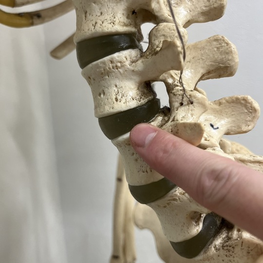 非特異性腰痛は「椎間関節腰痛」「椎間板腰痛」「筋・筋膜性腰痛」「仙腸関節性腰痛」に別れる