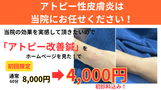 オオヤ鍼灸整骨院　姫路駅前店の過敏性腸症候群改善鍼　初回割引