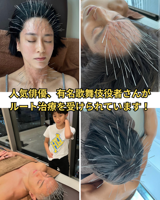 ルート治療は俳優の窪田正孝さん、水川あさみさん、歌舞伎俳優の市川海老蔵さんなど様々な方が受けられています